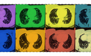 Abdominal CT with solid colors behind the scans in a rainbow esque pattern.